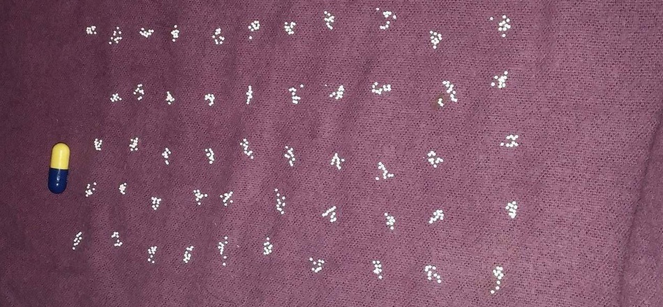 Bead-counting Surface