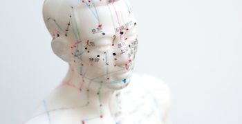 Acupuncture