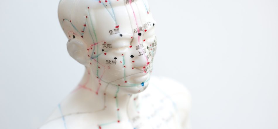 Acupuncture
